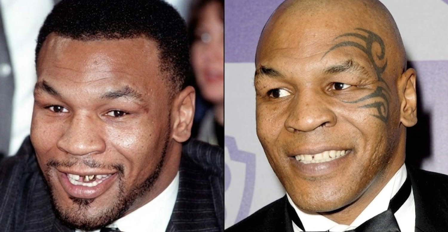 Mike Tyson